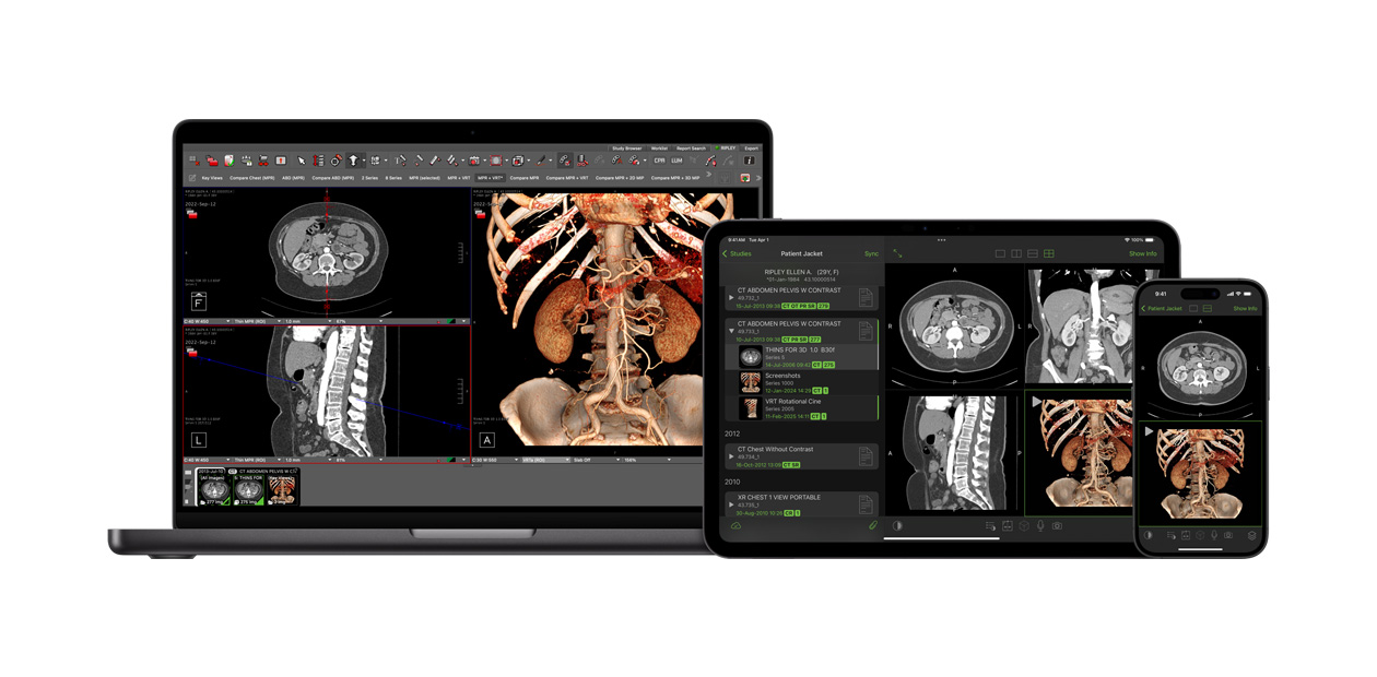 Programvare som viser Visage-appen, som radiologer bruker til å tolke store diagnosefiler.
